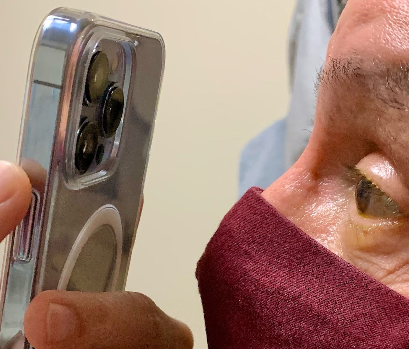 El modo macro del iPhone 13 Pro también es útil para los médicos